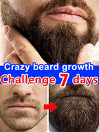 Unisex Hair Growth Serum For Beard, Hair And Body